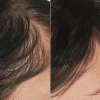 Scalp Serum