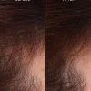 Scalp Serum